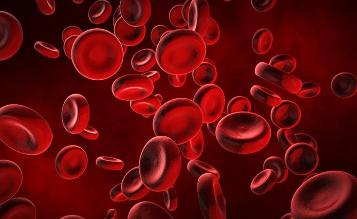 الأنيميا هي مرض يصيب خلايا الدم الحمراء
